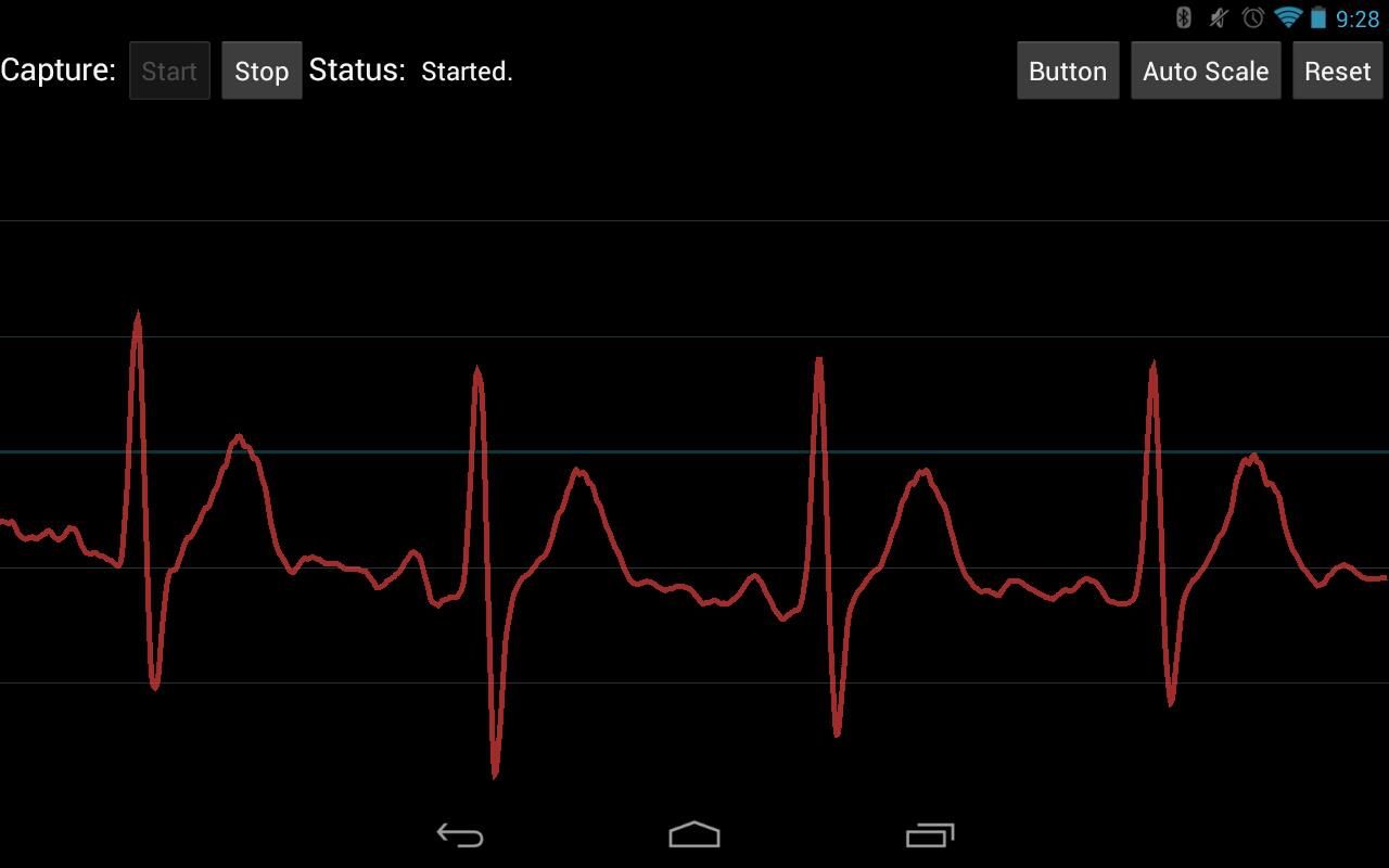 CardioTag by LebenTek