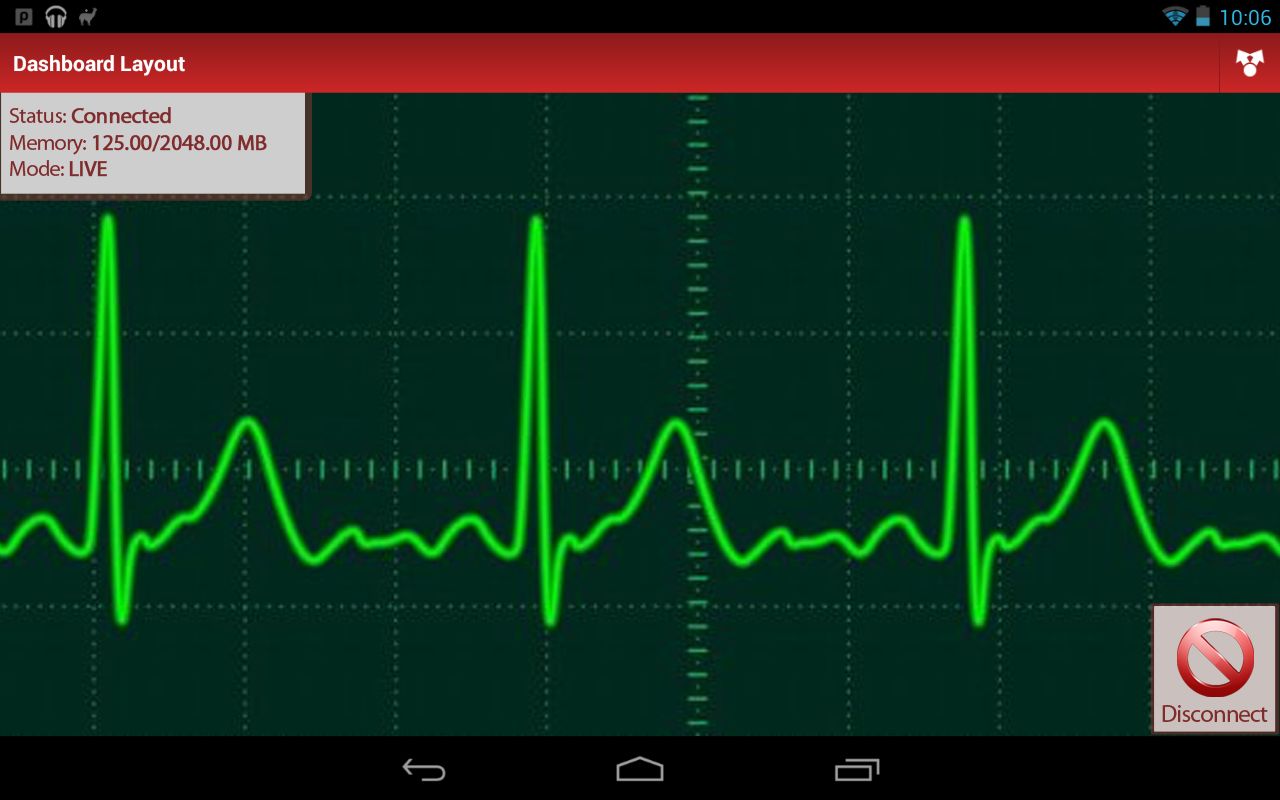 Concept art for the mobile app UI graph page to see the live and stored ECG signal.